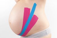 Der Bauch einer Schwangeren mit Kinesio-Tapes